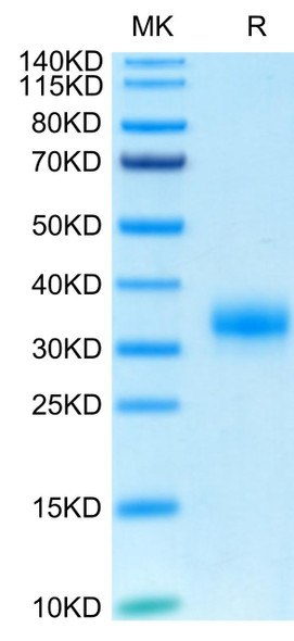 Biotinylated Recombinant Human Fc gamma RIIA/FCGR2A/CD32a (H167R) Protein (RPCB0626)
