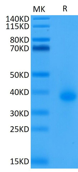 Biotinylated Recombinant Human TNFRSF5/CD40 Protein (RPCB0646)