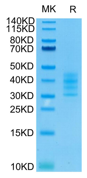 Recombinant HumanTNFRSF17/BCMA/CD269 Trimer Protein (RPCB0667)