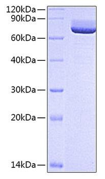 Recombinant Rat 5'-Nucleotidase/NT5E/CD73 Protein (RPCB0676)