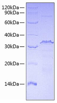 Recombinant Human Transcriptional Repressor Ctcf/CTCF Protein (RPCB0695)