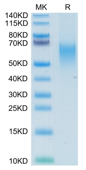 Recombinant Human B7-1/CD80 Protein (RPCB0698)
