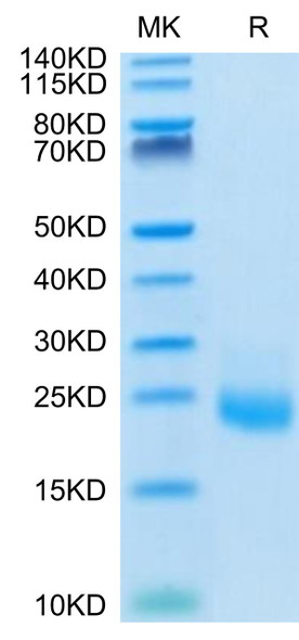 Recombinant Human IL-31 Protein (RPCB0702)