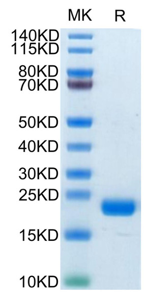 Biotinylated Recombinant Human MS4A1/CD20 Protein (RPCB0712)