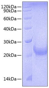 Recombinant Mouse TNFSF4/OX40 ligand/CD252 Protein (RPCB0718)