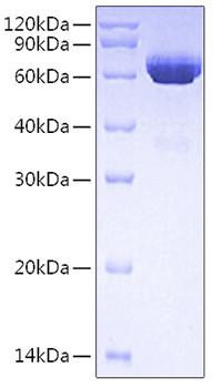 Recombinant Human Tissue-type plasminogen activator/TPA/PLAT Protein (RPCB0722)