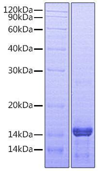 Recombinant Human Amphiregulin/AREG Protein (RPCB0735)
