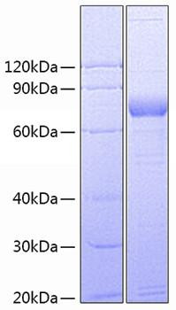 Recombinant Human SIRP-gamma/CD172g Protein (RPCB0747)