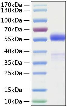 Recombinant Human Frizzled-1/FZD1 Protein (RPCB0748)