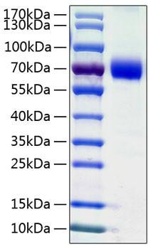 Recombinant Human B7-H5/Gi24/VISTA Protein (RPCB0750)