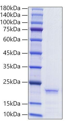 Recombinant Human Ferritin heavy chain/FTH1 Protein (RPCB0755)