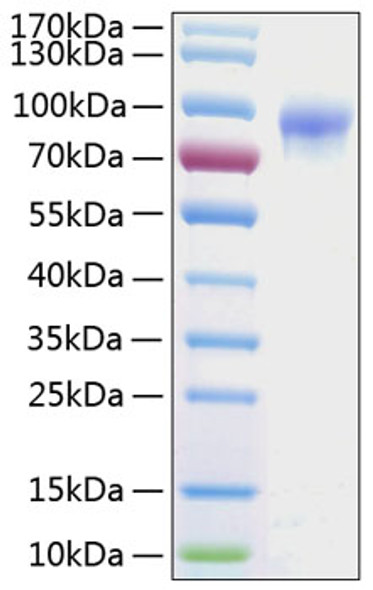 Recombinant Human IL-2RG/CD132 Protein (RPCB0765)