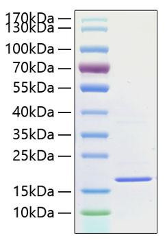 Recombinant Human IL-1F10 Protein (RPCB0819)