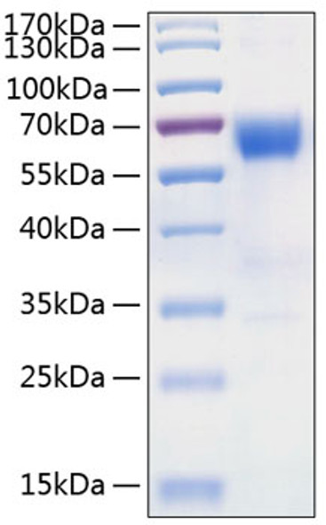Recombinant Human TNFRSF10D/DcR2/TRAIL-R4/CD264 Protein (RPCB0843)