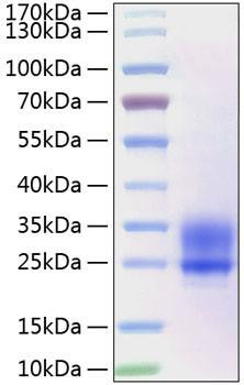 Recombinant Human Frizzled-5/FZD5 Protein (RPCB0857)