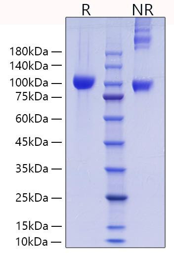 Recombinant Mouse MMP-9 Protein (RPCB0861)
