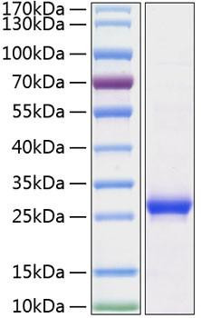 Recombinant Rat Lipocalin-2/NGAL/LCN2 Protein (RPCB0862)
