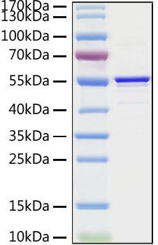 Recombinant SARS-CoV Nucleocapsid Protein (RPCB0867)