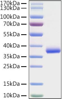 Recombinant SARS-COV-2 Spike RBD(K417N) Protein (RPCB0879)