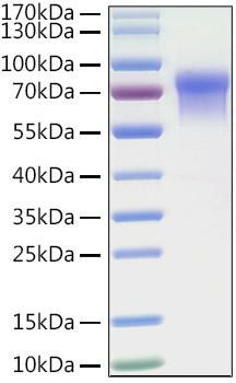 Recombinant Human LILRB1/ILT-2/CD85j Protein (RPCB0881)