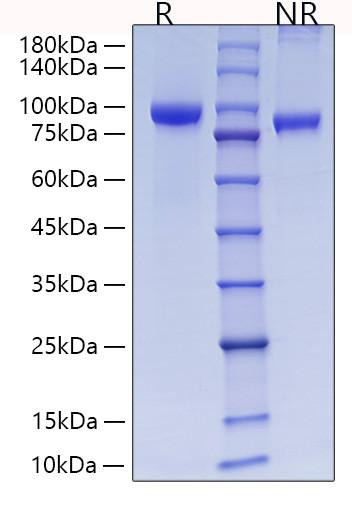 Recombinant Rat MMP-9 Protein (RPCB0893)
