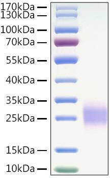 Recombinant Mouse CTLA-4/CD152 Protein (RPCB0894)