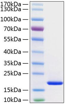 Recombinant Human FGF-1/aFGF Protein (RPCB0908)
