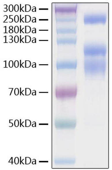 Recombinant SARS-CoV-2 Spike S1+S2 ECD(S-ECD)(D614G)  Protein (RPCB0924)