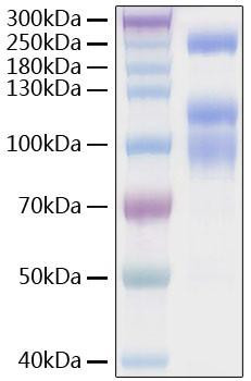 Recombinant SARS-CoV-2 Spike S1+S2 ECD(S-ECD)(D614G)  Protein (RPCB0924)
