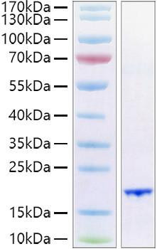 Recombinant Human FGF-6 Protein (RPCB0929)