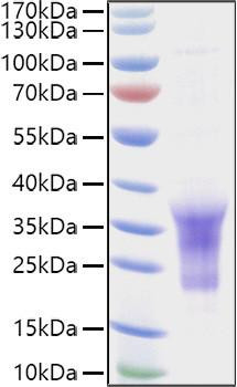 Recombinant Human B29/CD79B Protein (RPCB0933)