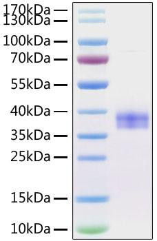 Recombinant Mouse Siglec-15/CD33L3 Protein (RPCB0936)