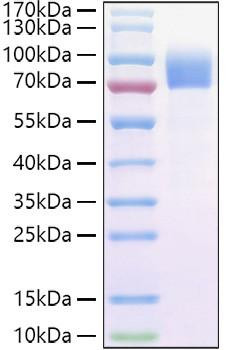 Recombinant Cynomolgus IL-2RG/CD132 Protein (RPCB0950)