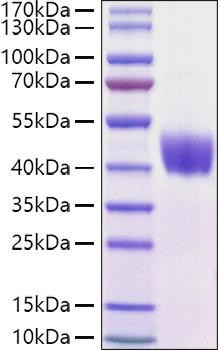 Recombinant Mouse Mesothelin/MSLN Protein (RPCB0953)