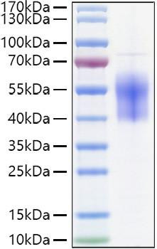 Recombinant Human B7-H6/NCR3LG1 Protein (RPCB0980)
