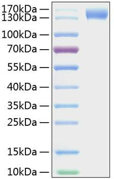 Recombinant Mouse P-Selectin/SELP/CD62P Protein (RPCB0988)