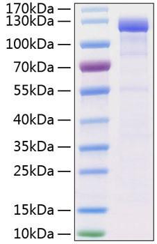 Recombinant Human VE-cadherin/CDH5/CD144 Protein (RPCB0995)