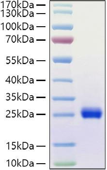 Recombinant Human Ephrin-A1/EFNA1 Protein (RPCB1022)