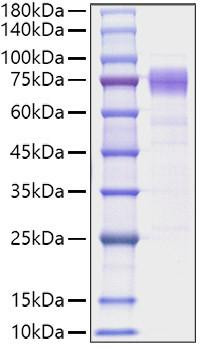 Recombinant Human IL-10RA/CD210 Protein (RPCB1027)
