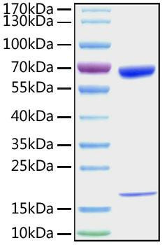 Recombinant Mouse PCSK9 Protein (RPCB1031)