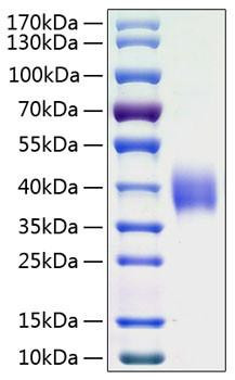 Recombinant Human B7-H3/CD276 Protein (RPCB1035)
