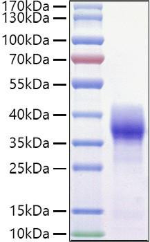 Recombinant Mouse Basigin/EMMPRIN/CD147 Protein (RPCB1041)
