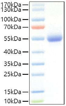 Recombinant Mouse IL-5RA/CD125 Protein (RPCB1051)