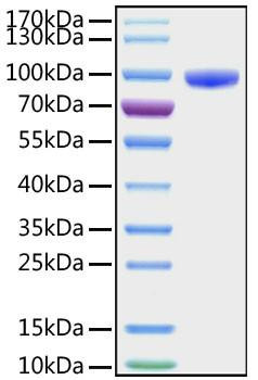 Recombinant Human CD177 Protein (RPCB1054)