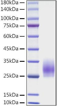 Recombinant Mouse CD83 Protein (RPCB1074)