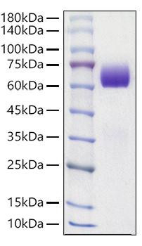 Recombinant Mouse Tyrosine-protein kinase receptor UFO/Axl Protein (RPCB1077)