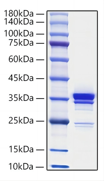 Recombinant Mouse HMGB1 Protein (RPCB1103)