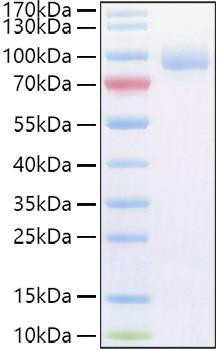 Recombinant Human Vasorin/SLITL2/VASN Protein (RPCB1122)