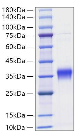 Recombinant Mouse IFN-beta Protein (RPCB1123)