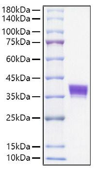 Recombinant Mouse Ep-CAM/TROP-1/CD326 Protein (RPCB1129)